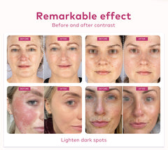 LANMEIREN Hot Sale LED PDT Machine Skin Care LED Light Therapy Machine PDT LED Skin Acne Treatment for Face, Neck, Arm, Leg, and Body