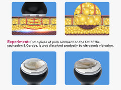 LANMEIREN Ultrasonic Body Slimming System, 5in1 80K Radiofrequency Cavitation Machine, Fat Burning Cellulite Body Massager