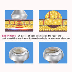 LANMEIREN 6in1 80k RF Ultrasonic Vacuum Cavitation System, for Fat Burning Body Slimming Sculpting, with EMS Pads