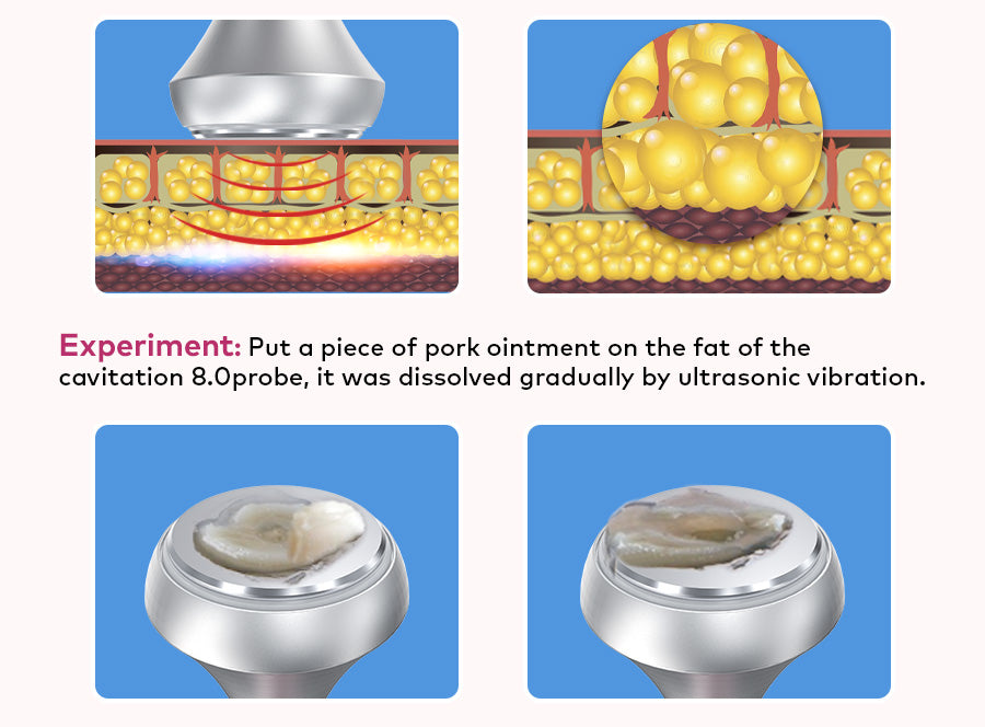 ultra cavitation machine