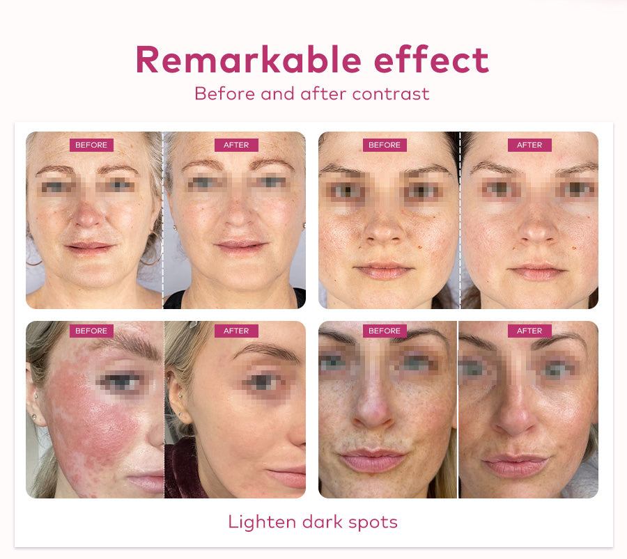 red light therapy for wrinkles