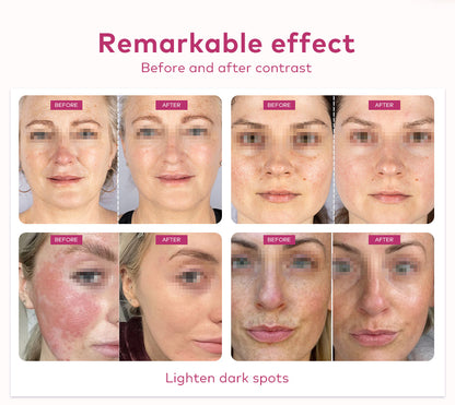 red light therapy for wrinkles