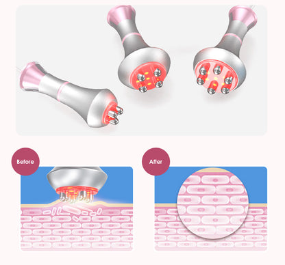 radio frequency facial