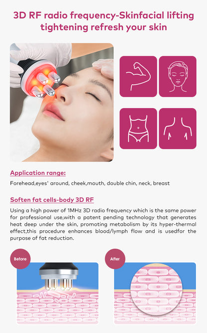 radio frequency skin tightening