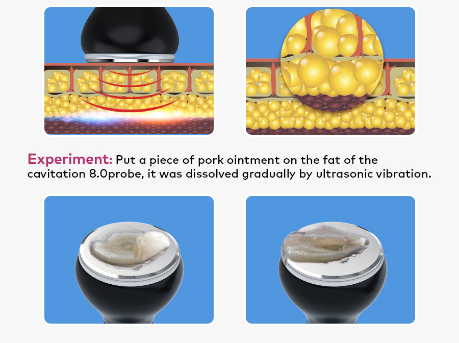 LANMEIREN Ultrasonic Body Slimming System, 5in1 80K Radiofrequency Cavitation Machine, Fat Burning Cellulite Body Massager