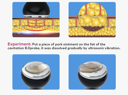 80k or 40k cavitation