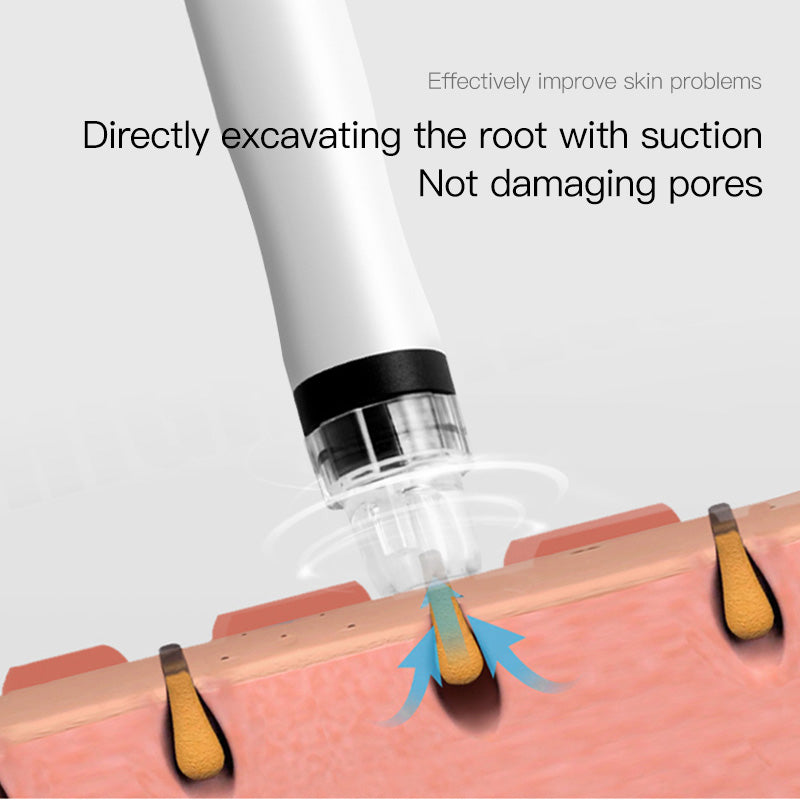 7 in 1 Hydro Dermabrasion Facial Machine | Microdermabrasion & Deep Cleansing — LANMEIREN