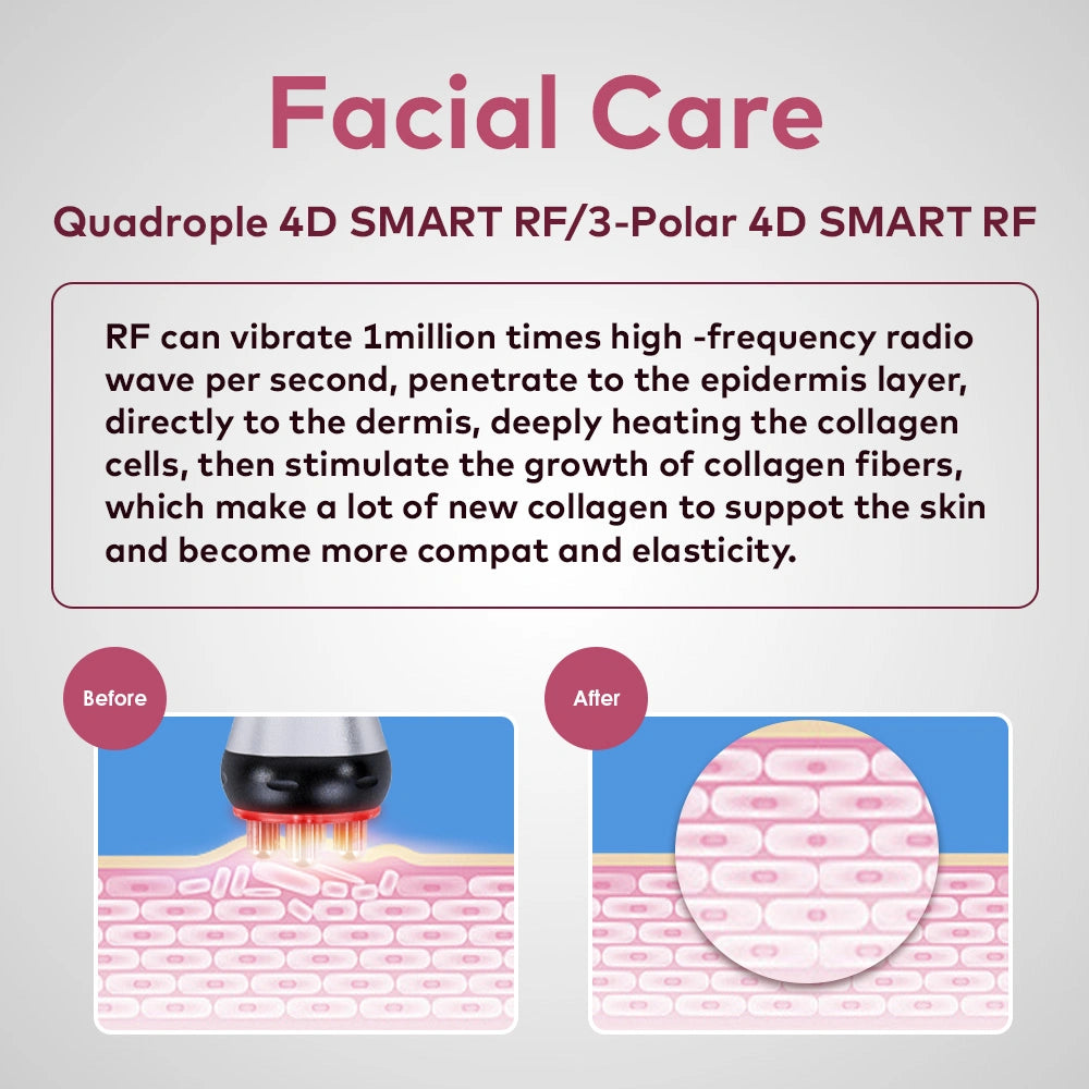 smooth radio frequency