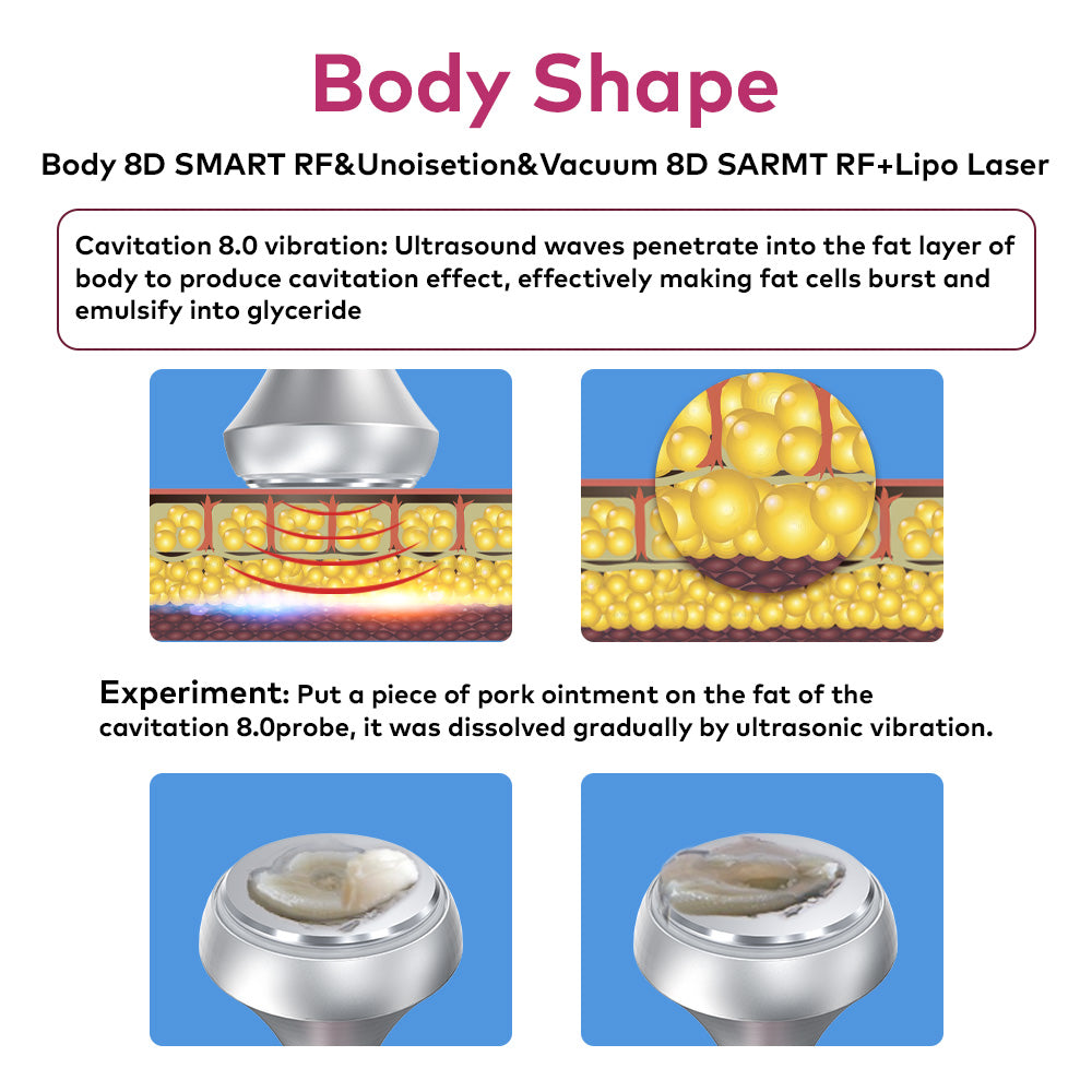 ultrasound to reduce fat