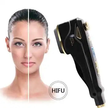 HIFU wrinkle remove