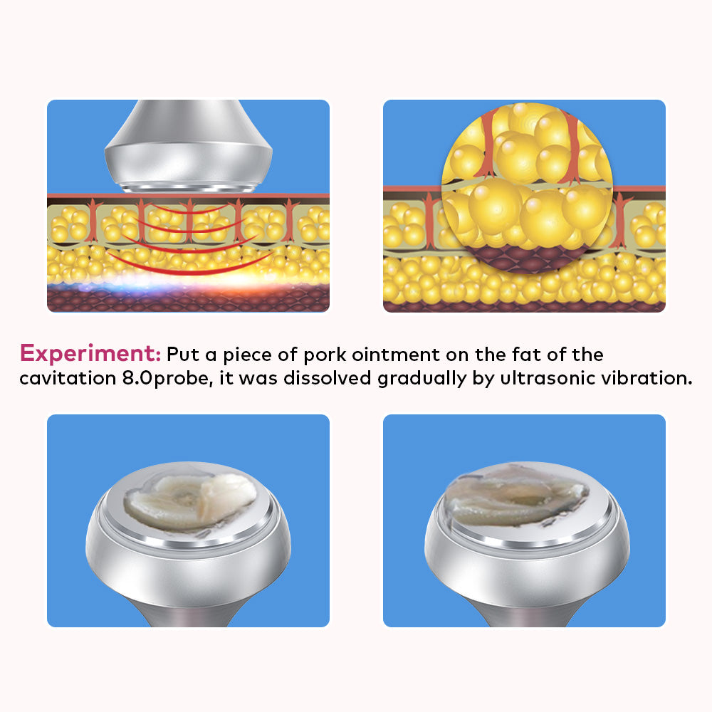 LANMEIREN 80K Cavitation Machine 6in1  Radiofrequency, with laser Pads, Ultrasonic Body Slimming System, Fat Burning Cellulite Body Massager