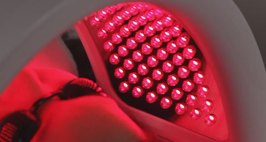 yellow light therapy before and after