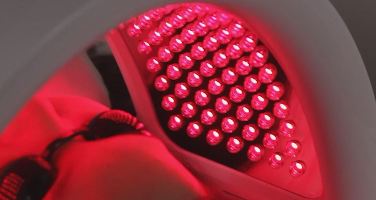 yellow light therapy before and after